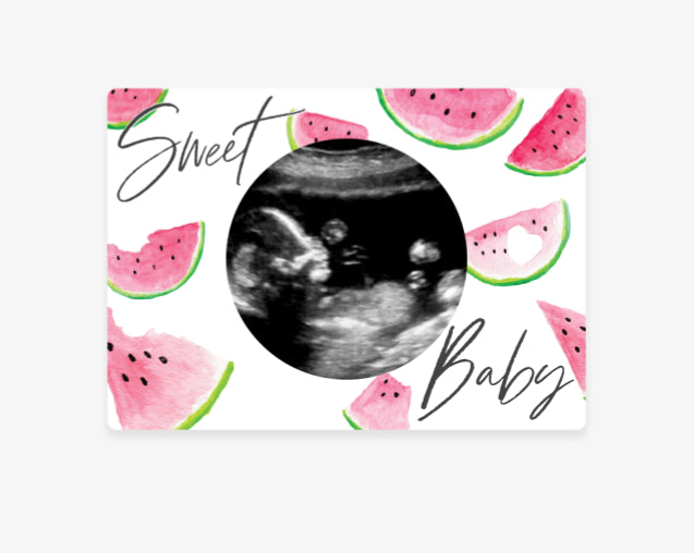 Sweet Watermelon Magnetic Ultrasound Photo Frame