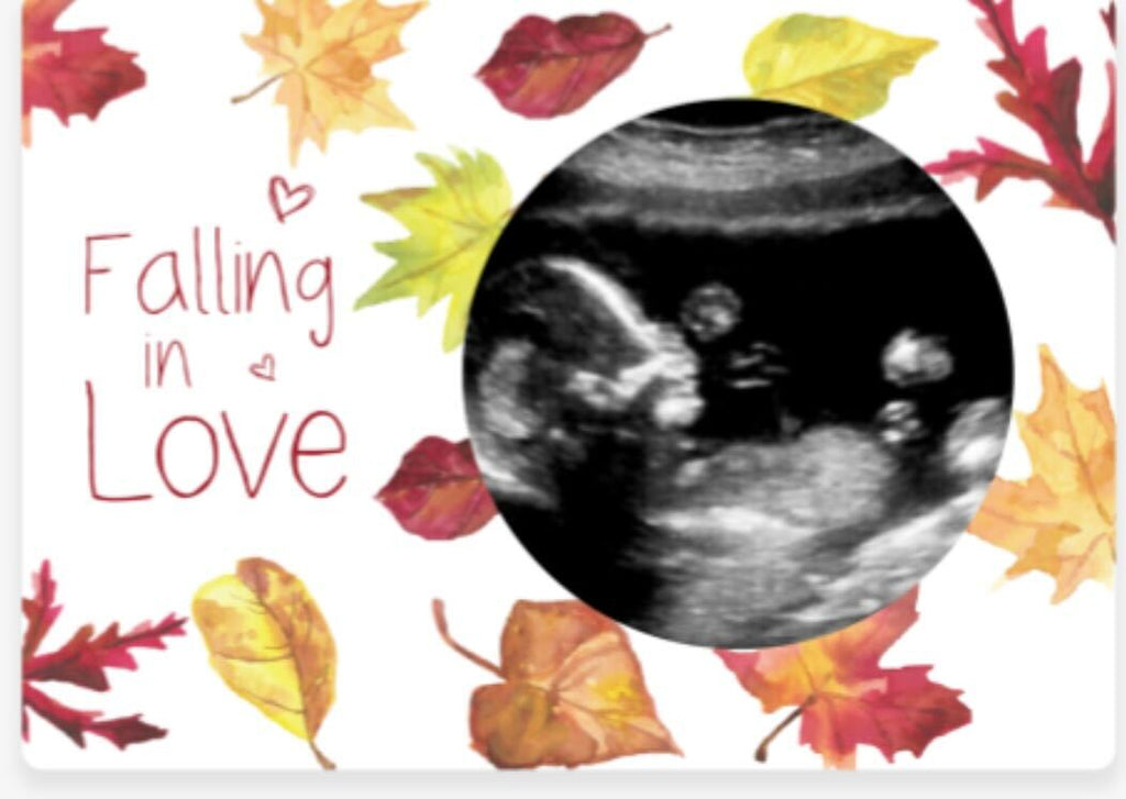 Falling in Love Magnetic Ultrasound Photo Frame