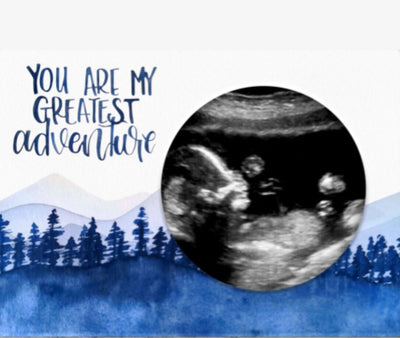 Adventure Magnetic Ultrasound Photo Frame