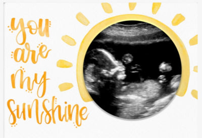 Sunshine Magnetic Ultrasound Photo Frame