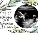 Grandparents Love Magnetic Ultrasound Photo Frame